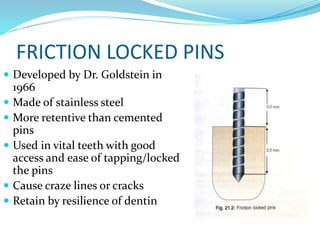 FRICTION LOCKED PINS
 Developed by Dr. Goldstein in
1966
 Made of stainless steel
 More retentive than cemented
pins
 Used in vital teeth with good
access and ease of tapping/locked
the pins
 Cause craze lines or cracks
 Retain by resilience of dentin
 