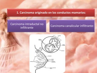 1. Carcinoma originado en los conductos mamarios:

Carcinoma intraductal no
infiltrante

Carcinoma canalicular infiltrante:

 