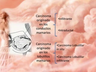 Carcinoma
originado
en los
conductos
mamarios
Carcinoma
originado
en los
lobulillos
mamarios

•Infiltrante

•Intraductal

•Carcinoma Lobulillar
in situ
•Carcinoma Lobulillar
infiltrante

 