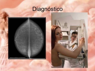 Diagnóstico

 