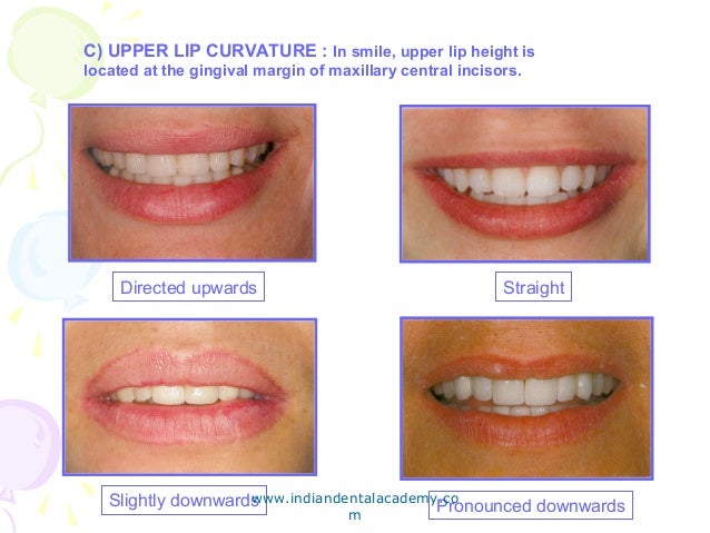 denture esthetics courses dentistry cosmetic curvature endodontic