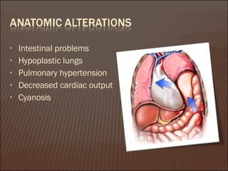 Intestinal problems Hypoplastic lungs  Pulmonary hypertension Decreased cardiac output Cyanosis 