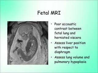 Fetal MRI
• Poor accoustic
contrast between
fetal lung and
herniated viscera
• Assess liver position
with respect to
diaphragm
• Assess lung volume and
pulmonary hypoplasia
 