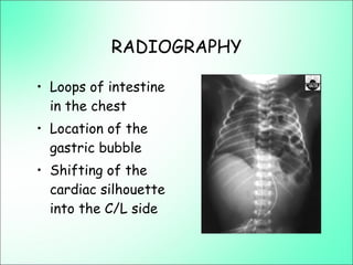 RADIOGRAPHY
• Loops of intestine
in the chest
• Location of the
gastric bubble
• Shifting of the
cardiac silhouette
into the C/L side
 