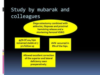Study by mubarak and
colleagues
Dega osteotomy combined with
adductor, iliopsoas and proximal
hamstring release and a
shortening femoralVDRO
95% Of 104 hips
remained stable at 7
yrs follow up
AVN occurred in
8% of the hips.
Allowed excellent correction
of the superior and lateral
deficiency seen
preoperatively.
 