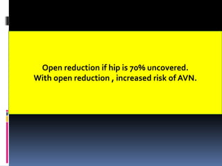 Open reduction if hip is 70% uncovered.
With open reduction , increased risk of AVN.
 