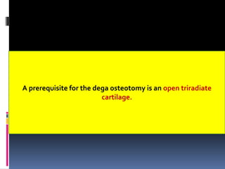 A prerequisite for the dega osteotomy is an open triradiate
cartilage.
 