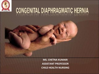 MS. CHETNA KUMARI
ASSISTANT PROFESSOR
CHILD HEALTH NURSING
 