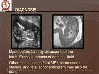 Made before birth by ultrasound of the
fetus Excess amounts of amniotic fluid
•
•
• Other tests such as fetal MRI, chromosome
studies and fetal echocardiogram may also be
done
PROGRAMME- B.Sc. Nursing Course- Child Health Nursing
 