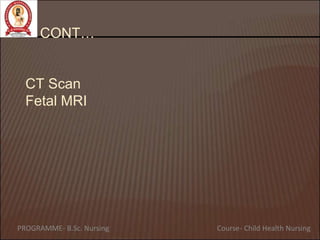 CONT…
CT Scan
Fetal MRI
PROGRAMME- B.Sc. Nursing Course- Child Health Nursing
 