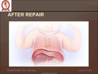 AFTER REPAIR
PROGRAMME- B.Sc. Nursing Course- Child
 