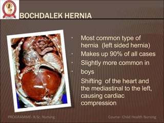BOCHDALEK HERNIA
•
•
•
•
Most common type of
hernia (left sided hernia)
Makes up 90% of all cases
Slightly more common in
boys
Shifting of the heart and
the mediastinal to the left,
causing cardiac
compression
PROGRAMME- B.Sc. Nursing Course- Child Health Nursing
 
