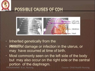 Inherited genetically from the
parents.
•
•
•
Result of damage or infection in the uterus, or
may have occurred at time of birth.
Most commonly seen on the left side of the body
but may also occur on the right side or the central
portion of the diaphragm.
PROGRAMME- B.Sc. Nursing Course- Child Health Nursing
 