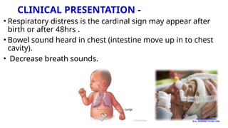 CLINICAL PRESENTATION -
• Respiratory distress is the cardinal sign may appear after
birth or after 48hrs .
• Bowel sound heard in chest (intestine move up in to chest
cavity).
• Decrease breath sounds.
MS. ANEETA SHARMA
M.Sc. NURSING TUTOR( CHN)
 