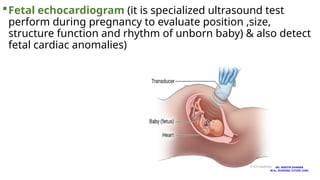 Fetal echocardiogram (it is specialized ultrasound test
perform during pregnancy to evaluate position ,size,
structure function and rhythm of unborn baby) & also detect
fetal cardiac anomalies)
MS. ANEETA SHARMA
M.Sc. NURSING TUTOR( CHN)
 