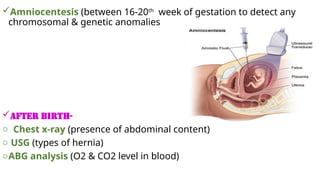 Amniocentesis (between 16-20th
week of gestation to detect any
chromosomal & genetic anomalies
AFTER BIRTH-
o Chest x-ray (presence of abdominal content)
o USG (types of hernia)
oABG analysis (O2 & CO2 level in blood)
 