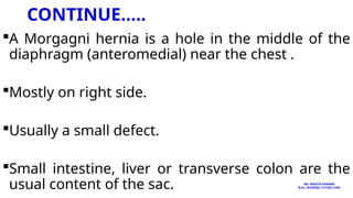 CONTINUE…..
A Morgagni hernia is a hole in the middle of the
diaphragm (anteromedial) near the chest .
Mostly on right side.
Usually a small defect.
Small intestine, liver or transverse colon are the
usual content of the sac. MS. ANEETA SHARMA
M.Sc. NURSING TUTOR( CHN)
 
