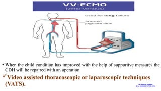 • When the child condition has improved with the help of supportive measures the
CDH will be repaired with an operation.
Video assisted thoracoscopic or laparoscopic techniques
(VATS). MS. ANEETA SHARMA
M.Sc. NURSING TUTOR( CHN)
 
