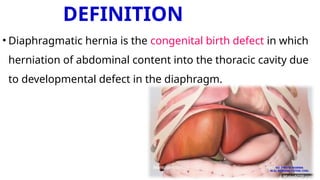 DEFINITION
• Diaphragmatic hernia is the congenital birth defect in which
herniation of abdominal content into the thoracic cavity due
to developmental defect in the diaphragm.
MS. ANEETA SHARMA
M.Sc. NURSING TUTOR( CHN)
 