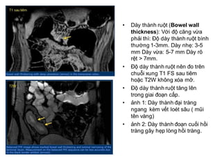 Hình ảnh MRI và
nội soi của cùng 1
BN
 