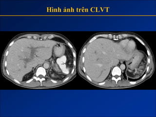 Hình ảnh trên CLVT
 