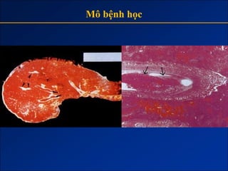 Mô bệnh học
 