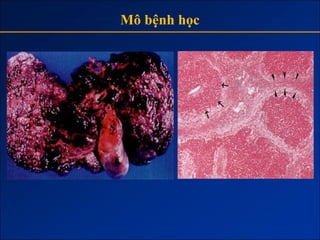 Mô bệnh học
 