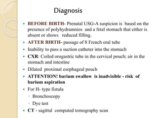 Diagnosis
 BEFORE BIRTH- Prenatal USG-A suspicion is based on the
presence of polyhydramnios and a fetal stomach that either is
absent or shows reduced filling.
 AFTER BIRTH- passage of 8 French oral tube
 Inability to pass a suction catheter into the stomach
 CXR: Coiled orogastric tube in the cervical pouch; air in the
stomach and intestine
 Dilated proximal esophageal pouch
 ATTENTION! barium swallow is inadvisible - risk of
barium aspiration
 For H- type fistula
◦ Bronchoscopy
◦ Dye test
 CT - sagittal computed tomography scan
 
