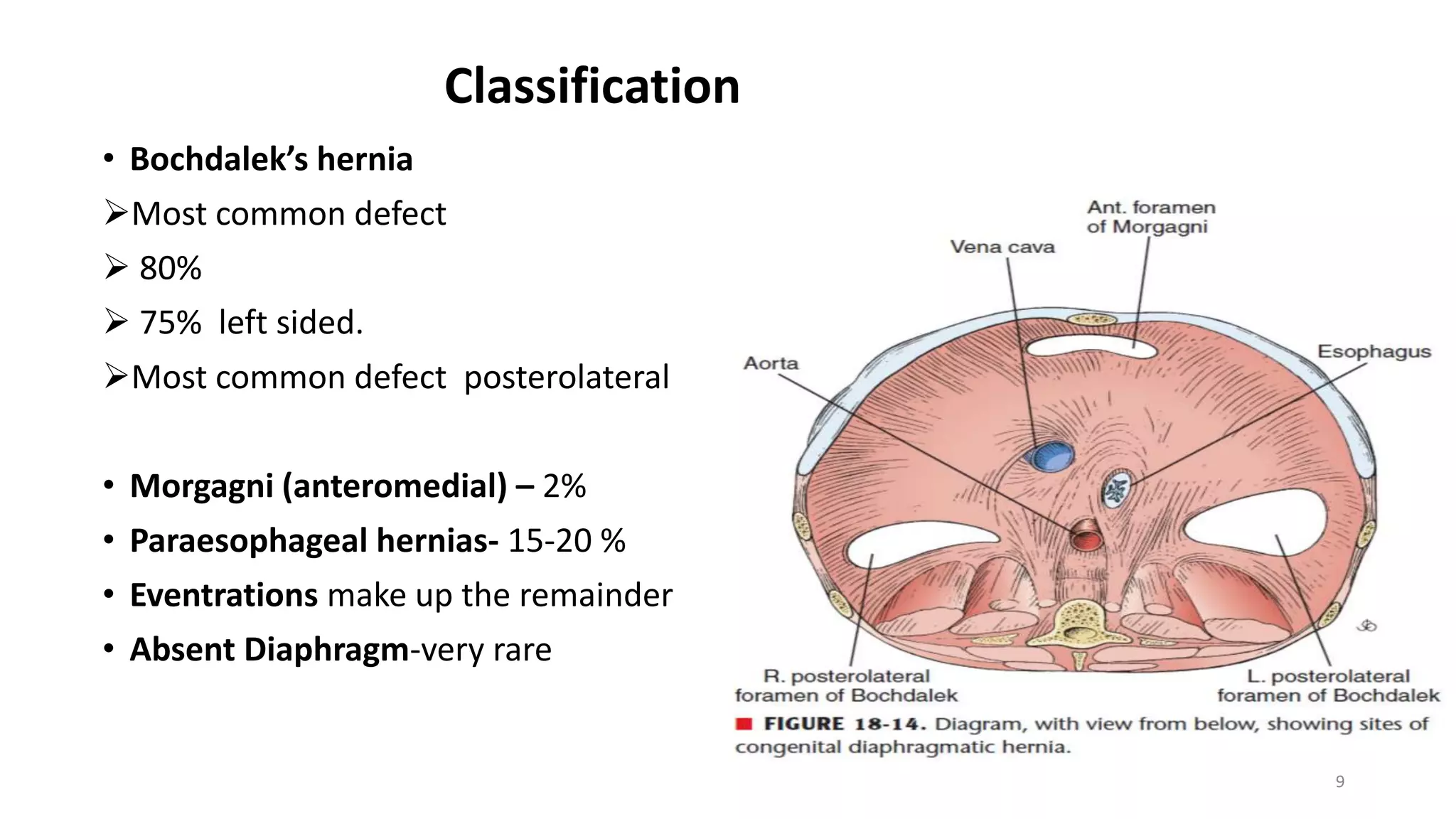 Anesthesia For Congenital Diaphragmatic Hernia | PPTX