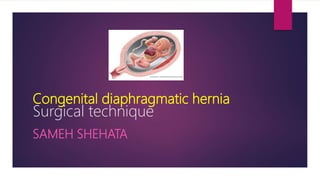 Congenital diaphragmatic hernia
Surgical technique
SAMEH SHEHATA
 