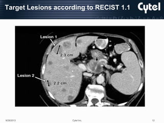 Recist Ecrf Cdisc Split CDISC journey using RECISIT 1.1 | PPTX