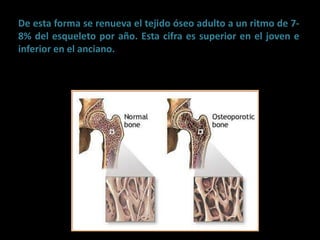 osteogénesis y remodelado óseo