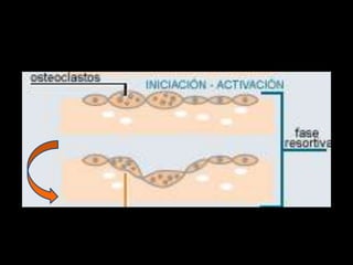 osteogénesis y remodelado óseo
