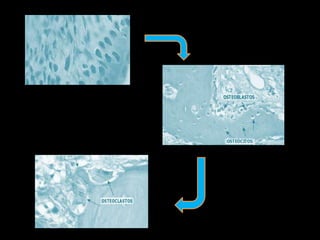osteogénesis y remodelado óseo