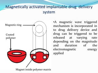 Magnetically activated implantable drug  delivery system A magnetic wave triggered mechanism is incorporated in to drug delivery device and drug can be triggered to be released at varying rate depending on the magnitude and duration of the electromagnetic energy appliedMagnetic ringCoated polymer Magnet inside polymer matrix