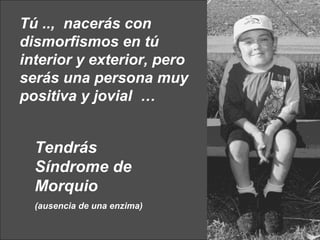 Tú ..,  nacerás con dismorfismos en tú interior y exterior, pero serás una persona muy positiva y jovial  … Tendrás S í ndrome de Morquio (ausencia de una enzima) 