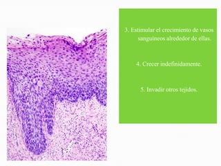 3. Estimular el crecimiento de vasos
      sanguíneos alrededor de ellas.



    4. Crecer indefinidamente.



      5. Invadir otros tejidos.
 