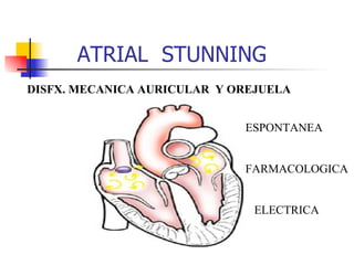 ATRIAL  STUNNING DISFX. MECANICA AURICULAR  Y OREJUELA ESPONTANEA FARMACOLOGICA ELECTRICA 