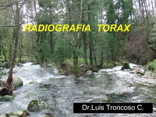 RADIOGRAFIA  TORAX Dr.Luis Troncoso C. 