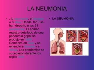 LA NEUMONIA , la  neumonía , el  dengue  o el  tifus . Desde 1510 se han descrito unas 31  pandemias . El primer registro detallado de una pandemia gripal se produjo en  1850 . Comenzó en  Asia  y se extendió a  Europa  y a  África . Las pandemias se sucedieron durante los siglos  XVII   LA NEUMONIA 