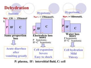 Dehydration   Same proportion  loss P IF C P IF C Electrolyte loss more P  hypotonic, IF+C  hypertonic Cell expansion Severe Easy to shock P: plasma,  IF:  interstitial fluid, C: cell Isotonic P IF C Water loss more P hypertonic IF+C  hypotonic Cell hydration Mild Thirsty   Acute diarrhea after vomiting greatly Hypotonic   Hypertonic  Na+  : 130 ～ 150mmol/L Na+:   <  130mmol/L Na+:   >  150mmol/L 