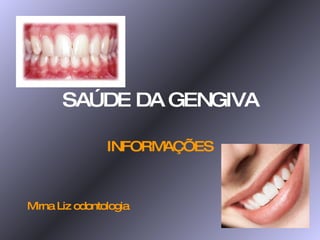 SAÚDE DA GENGIVA INFORMAÇÕES Mirna Liz odontologia 