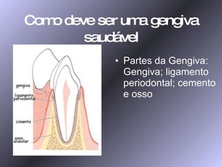 Como deve ser uma gengiva saudável Partes da Gengiva: Gengiva; ligamento periodontal; cemento e osso 