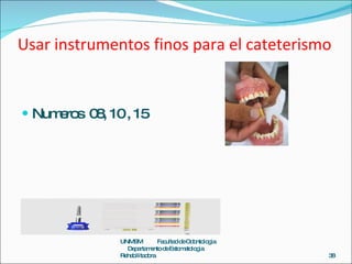 Usar instrumentos finos para el cateterismo <ul><li>Numeros  08, 10 , 15  </li></ul>UNMSM  Facultad de Odontologia  Depart...