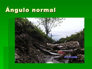 Ángulo normal