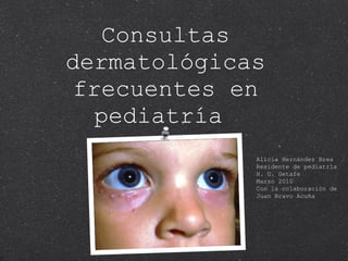 Consultas dermatológicas frecuentes en pediatría  Alicia Hernández Brea Residente de pediatría H. U. Getafe Marzo 2010 Con la colaboración de  Juan Bravo Acuña 