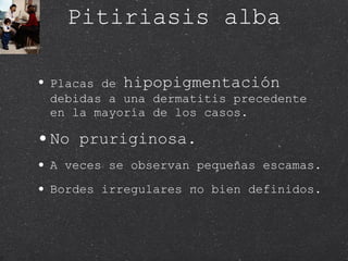 Pitiriasis alba Placas de  hipopigmentación  debidas a una dermatitis precedente en la mayoría de los casos. No pruriginosa. A veces se observan pequeñas escamas. Bordes irregulares no bien definidos. 