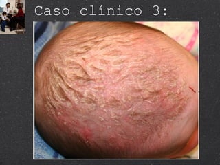 Caso clínico 3:  