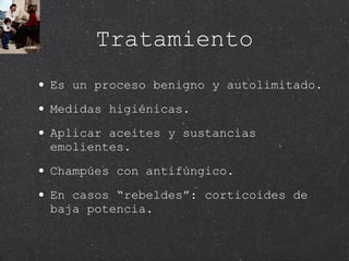 Tratamiento Es un proceso benigno y autolimitado. Medidas higiénicas. Aplicar aceites y sustancias emolientes. Champúes con antifúngico. En casos “rebeldes”: corticoides de baja potencia. 