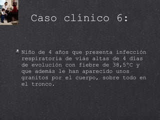 Caso clínico 6: Niño de 4 años que presenta infección respiratoria de vías altas de 4 días de evolución con fiebre de 38,5ºC y que además le han aparecido unos granitos por el cuerpo, sobre todo en el tronco. 